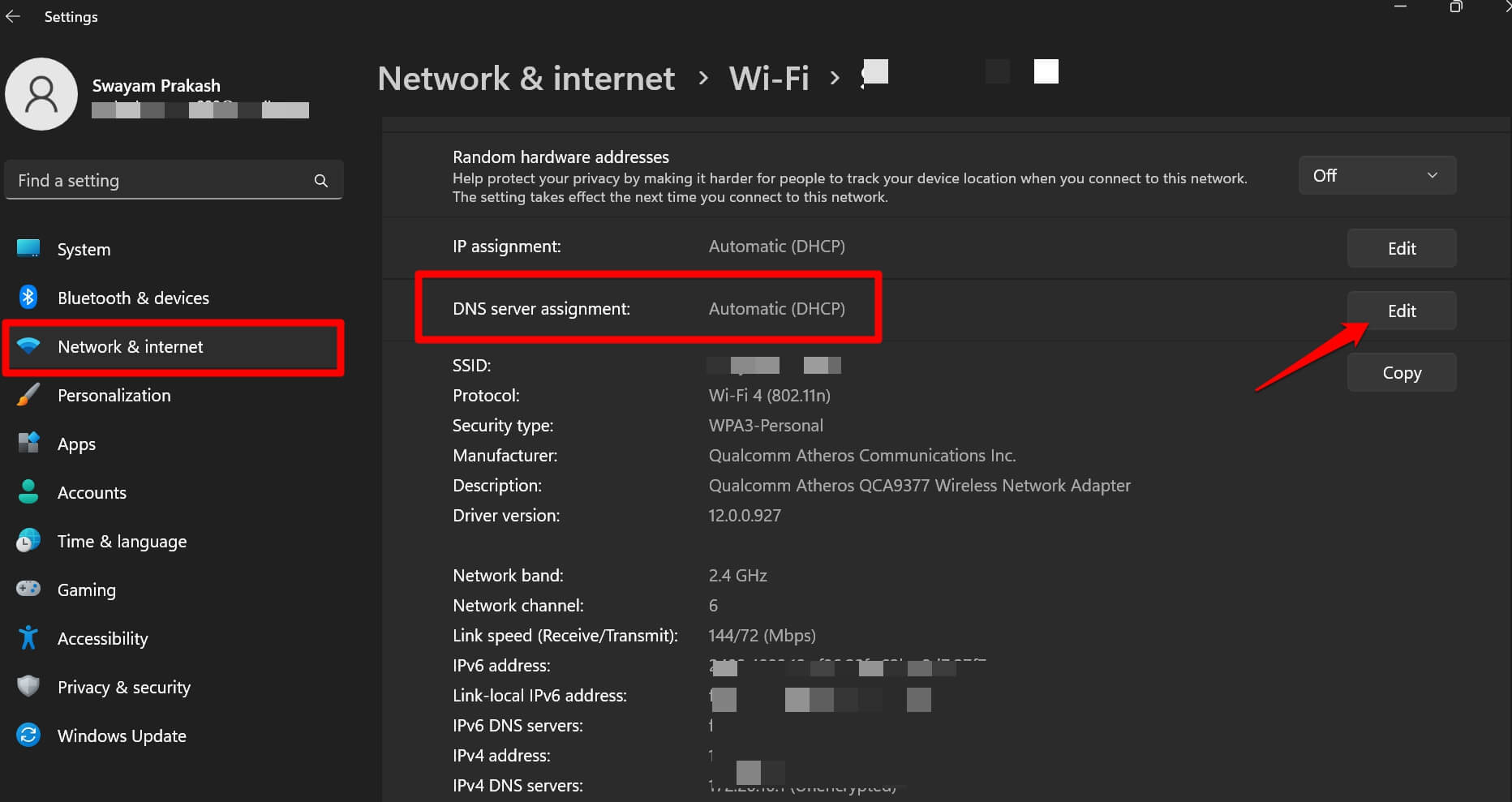 modifica il server DNS su Windows 11