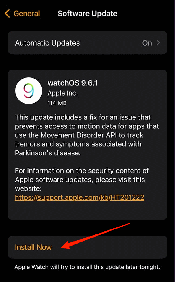 10 Maneras de Solucionar el Problema de Vibración del Apple Watch 2