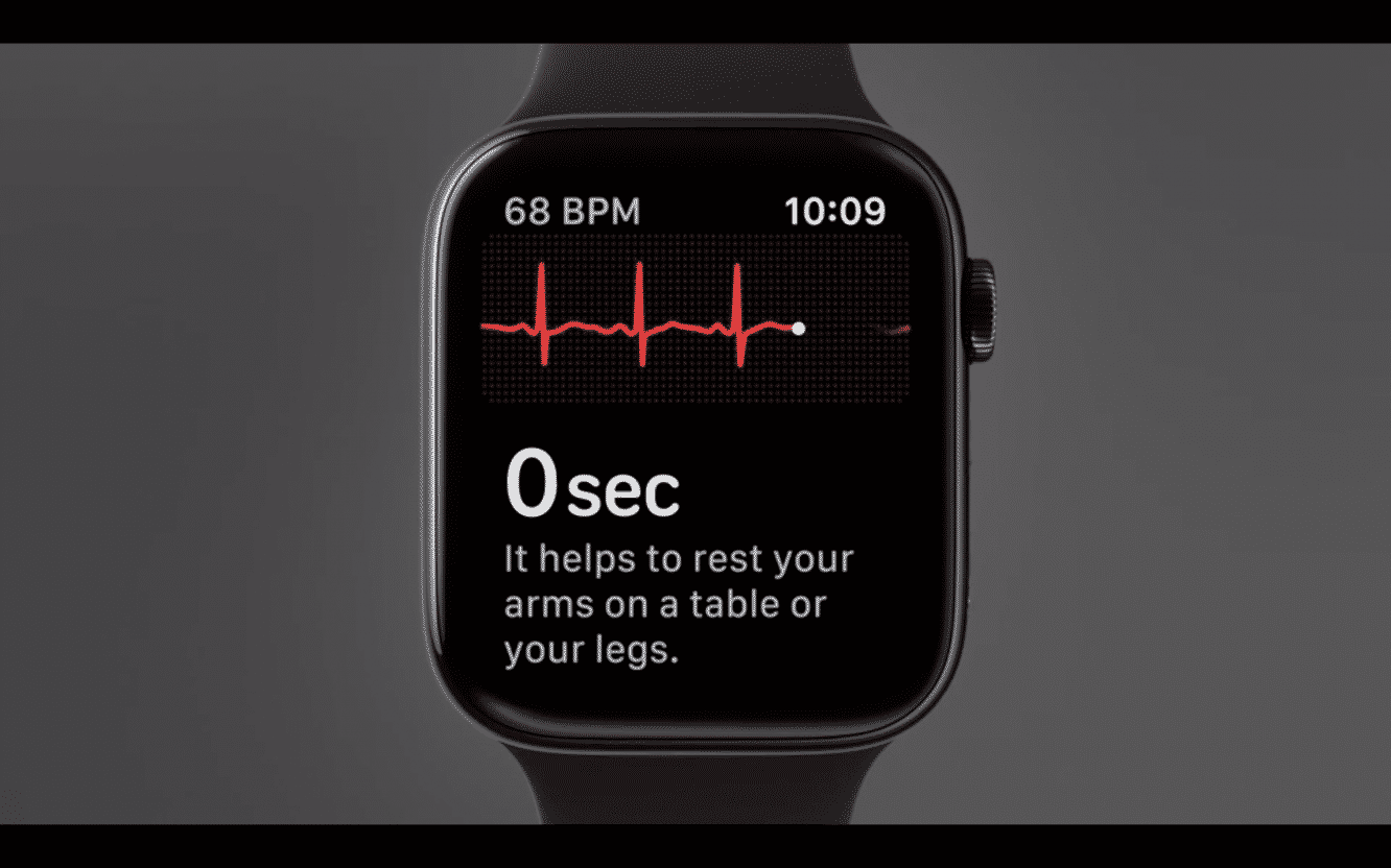 La technologie ECG de l'Apple Watch est utile mais "très rudimentaire"