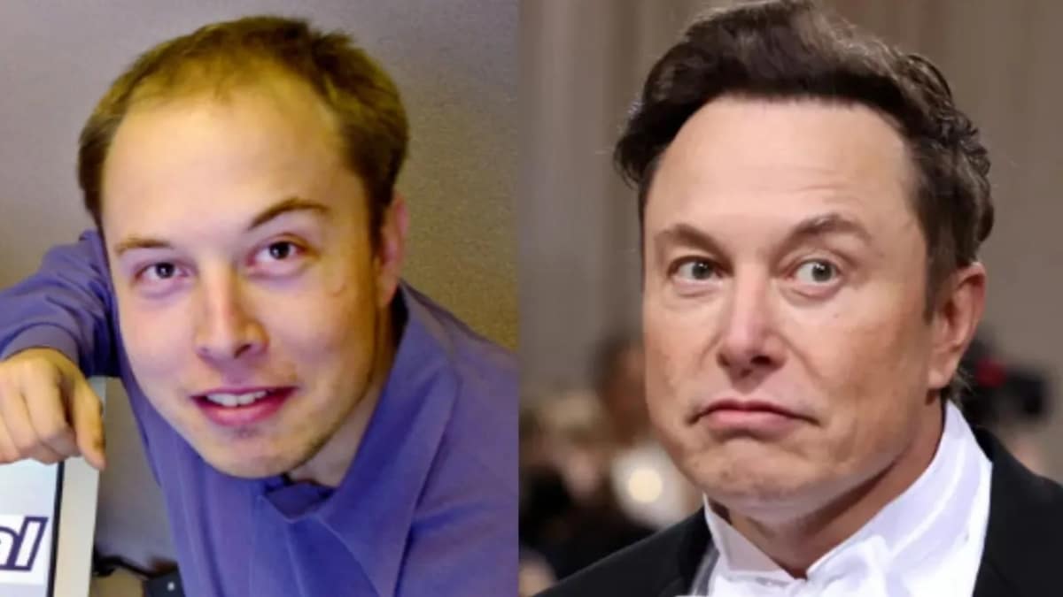 Qual é o segredo por trás do transplante de cabelo de Elon Musk?